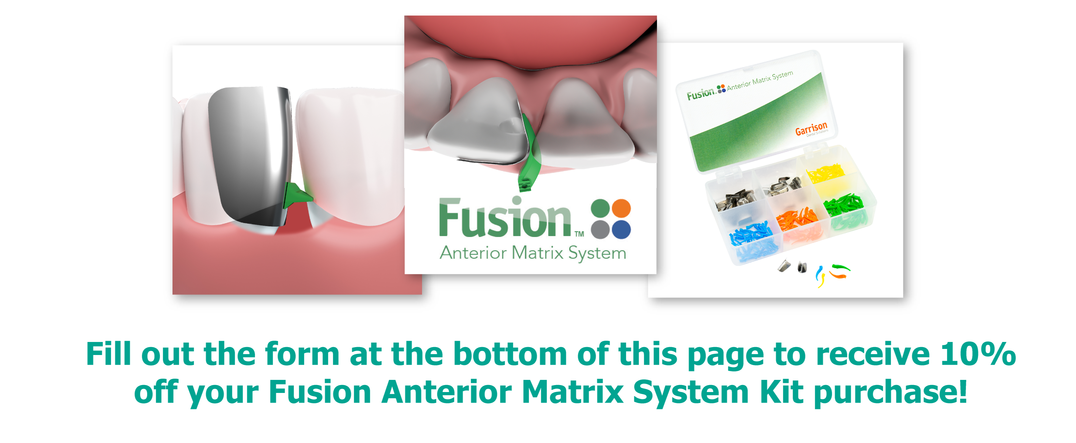 Fusion Anterior Matrix System From Garrison Garrison Dental